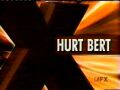Hurt Bert